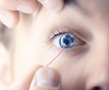 7506(6PR): ERG-Jet Contact Lens Electrodes (6 Pairs) Close up of doctor using ERG Jet electrode on patient's eye