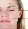 EZMRK Series: Skin Markers, Easily Removable Ink Green and red skin markers used on patient's face