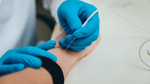 Disposable Surface Electrodes
